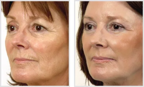Beauty age cream : kde nakúpiť na Slovensku, v lekárni?