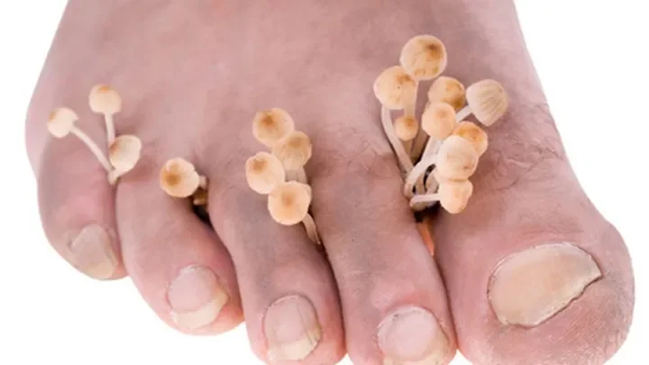 Exofeet oil : kde nakúpiť na Slovensku, v lekárni?