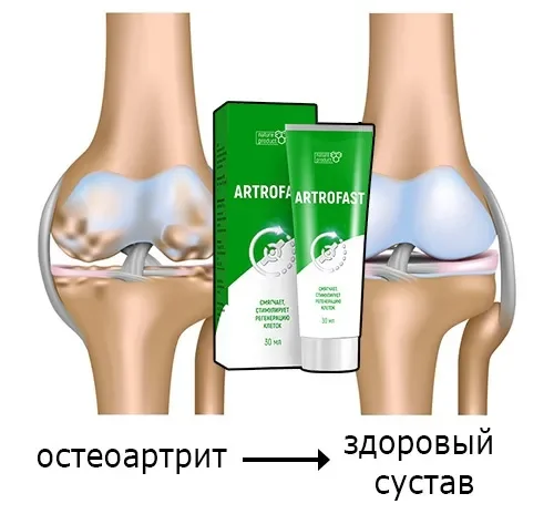 Flexosamine : zloženie iba prírodné zložky.