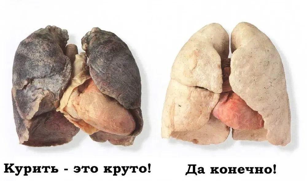 Nicozero (recenzie 2025) ✓ cena ✓ kúpiť ✓ Slovensko ✓ lekáreň.